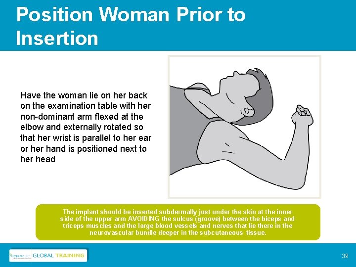 Position Woman Prior to Insertion Have the woman lie on her back on the