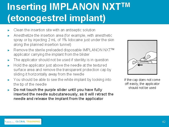 Inserting IMPLANON NXTTM (etonogestrel implant) ► ► ► ► Clean the insertion site with