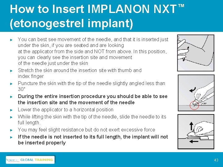 How to Insert IMPLANON NXT™ (etonogestrel implant) ► ► ► ► You can best