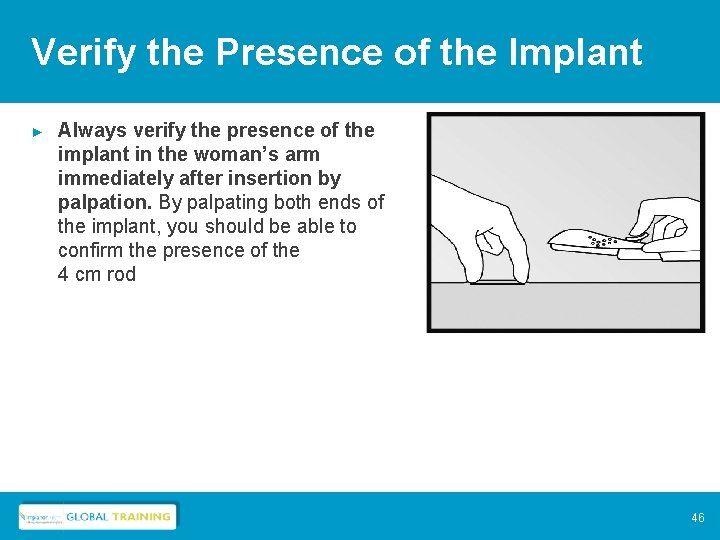 Verify the Presence of the Implant ► Always verify the presence of the implant