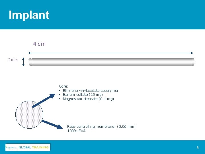 Implant 4 cm 2 mm Core: • Ethylene vinylacetate copolymer • Barium sulfate (15