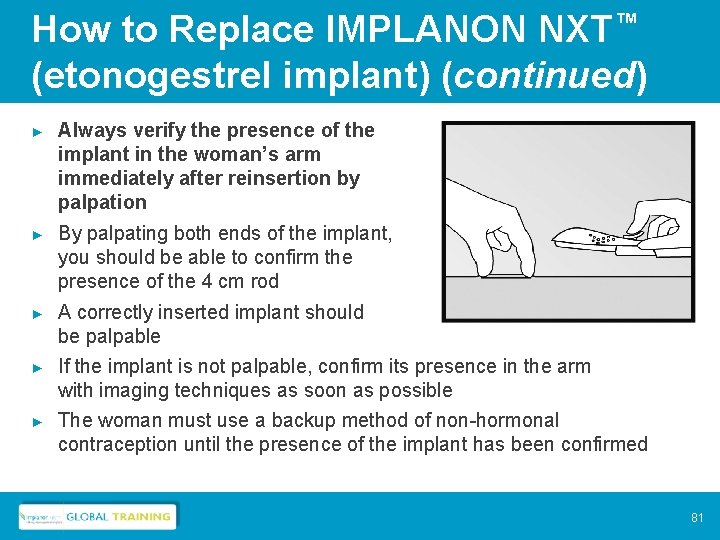 How to Replace IMPLANON NXT™ (etonogestrel implant) (continued) ► Always verify the presence of