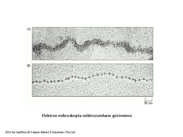 Elektron mikroskopta nükleozomların görünümü 2016 by Geoffery M. Cooper Robert E. Hausman; The Cell