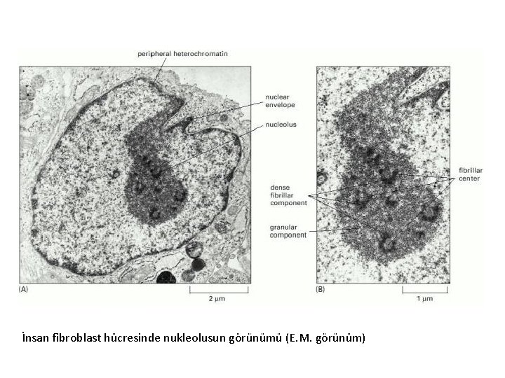 İnsan fibroblast hücresinde nukleolusun görünümü (E. M. görünüm) 