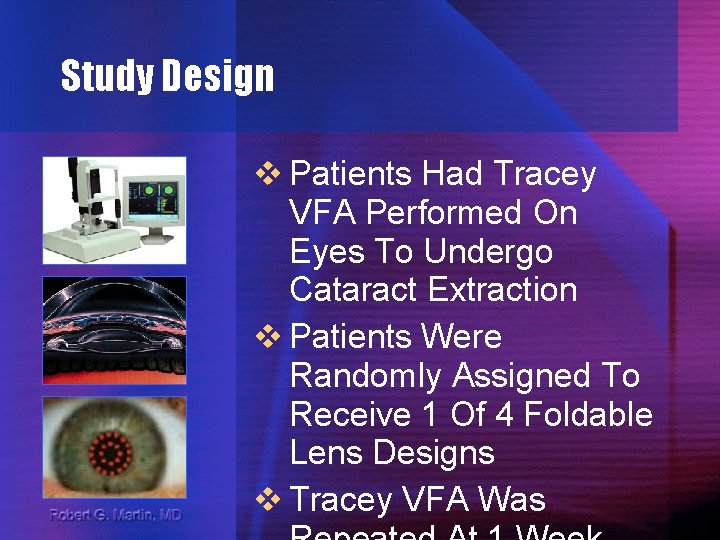 Study Design v Patients Had Tracey VFA Performed On Eyes To Undergo Cataract Extraction
