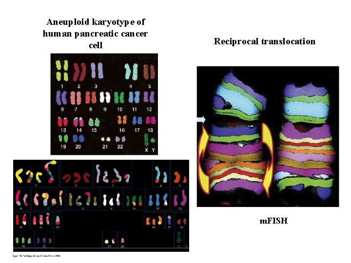 Aneuploid karyotype of human pancreatic cancer cell Reciprocal translocation m. FISH 