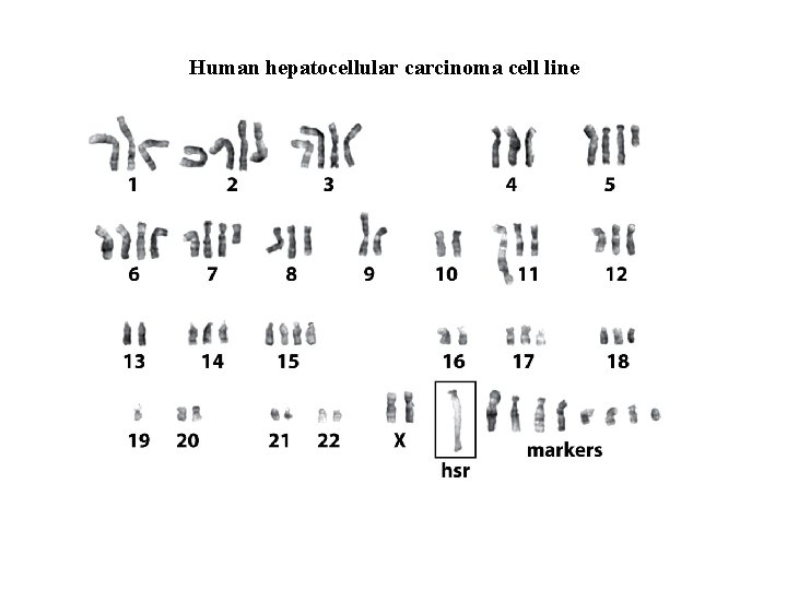 Human hepatocellular carcinoma cell line 