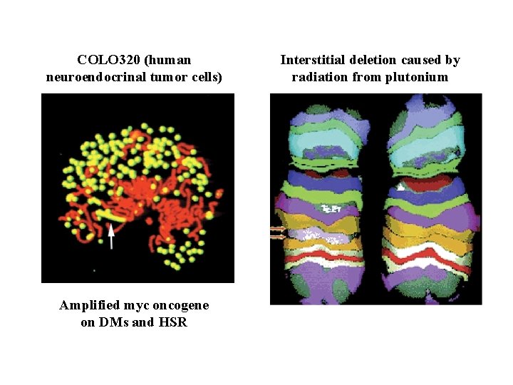 COLO 320 (human neuroendocrinal tumor cells) Amplified myc oncogene on DMs and HSR Interstitial