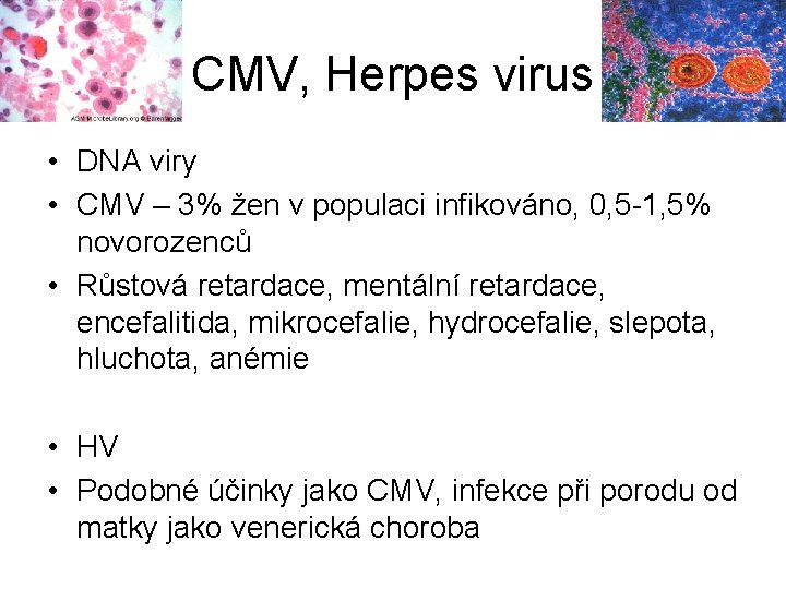 CMV, Herpes virus • DNA viry • CMV – 3% žen v populaci infikováno,
