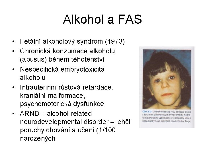 Alkohol a FAS • Fetální alkoholový syndrom (1973) • Chronická konzumace alkoholu (abusus) během