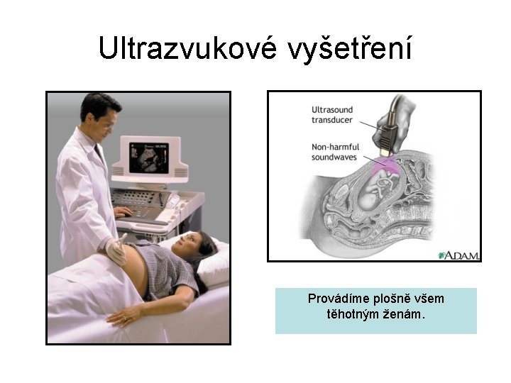 Ultrazvukové vyšetření Provádíme plošně všem těhotným ženám. 