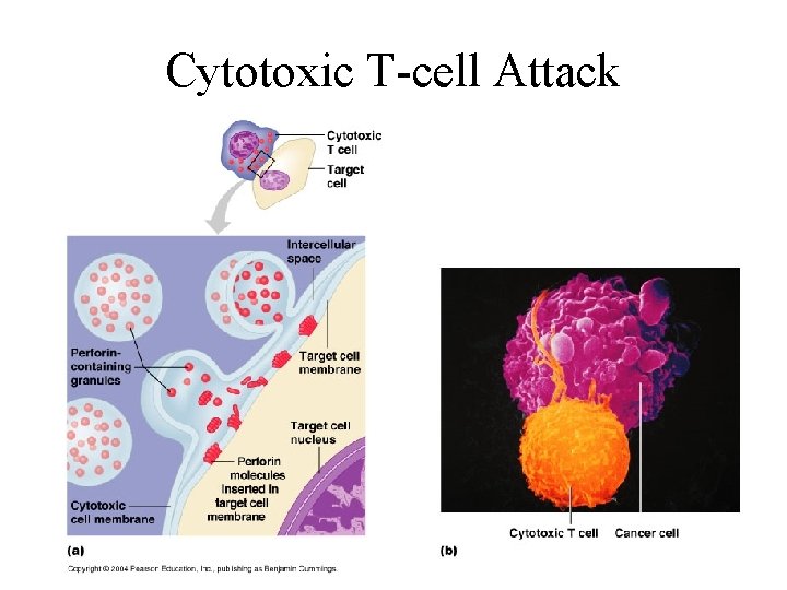Cytotoxic T-cell Attack 