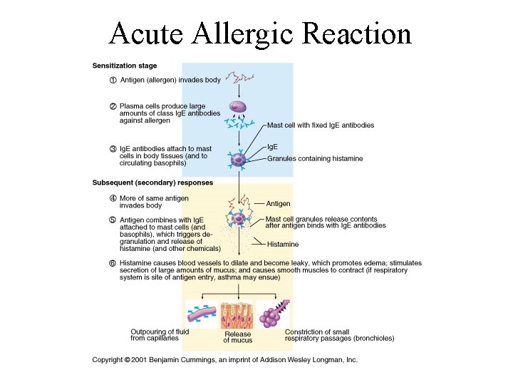 Acute Allergic Reaction 