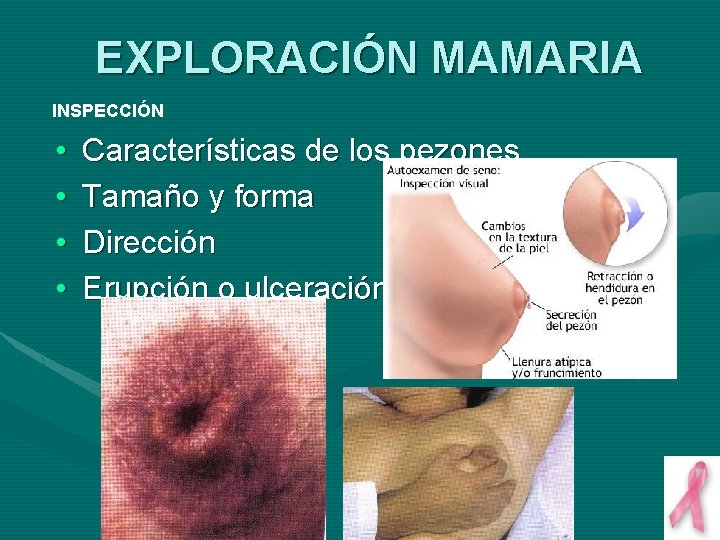 EXPLORACIÓN MAMARIA INSPECCIÓN • • Características de los pezones Tamaño y forma Dirección Erupción