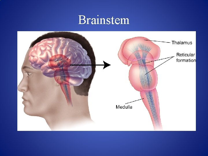 Brainstem 