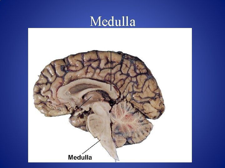 Medulla 