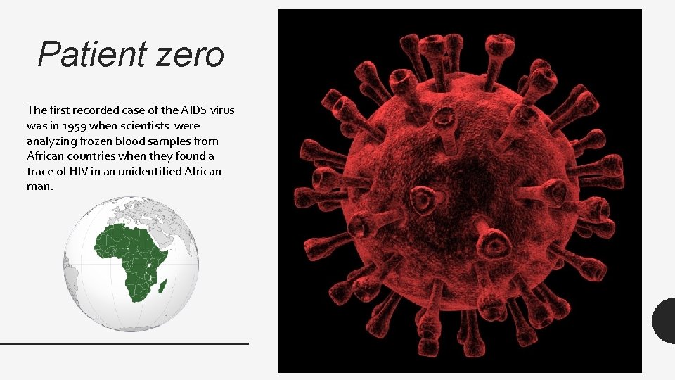 Patient zero The first recorded case of the AIDS virus was in 1959 when