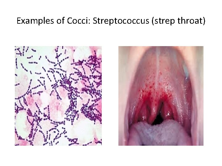 Examples of Cocci: Streptococcus (strep throat) 