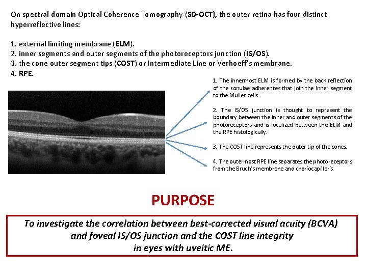 On spectral-domain Optical Coherence Tomography (SD-OCT), the outer retina has four distinct hyperreflective lines: