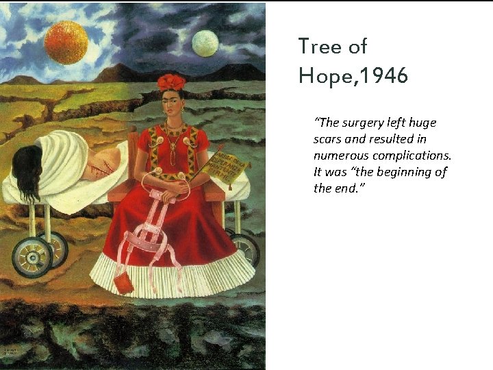 Tree of Hope, 1946 “The surgery left huge scars and resulted in numerous complications.