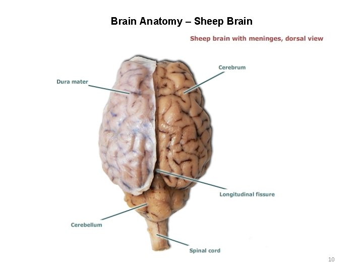 Brain Anatomy – Sheep Brain 10 