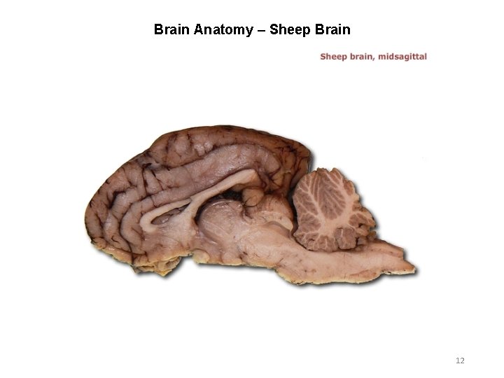 Brain Anatomy – Sheep Brain 12 