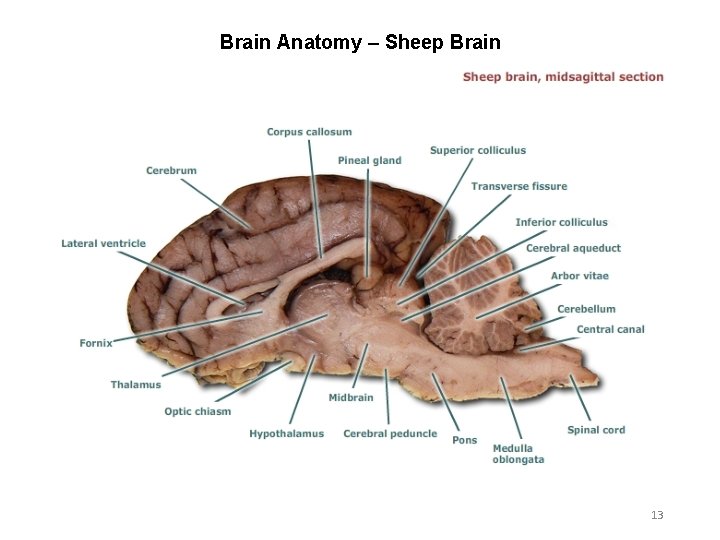 Brain Anatomy – Sheep Brain 13 