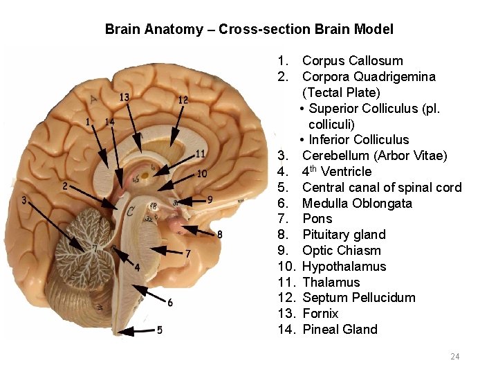 Brain Anatomy – Cross-section Brain Model 1. 2. Corpus Callosum Corpora Quadrigemina (Tectal Plate)