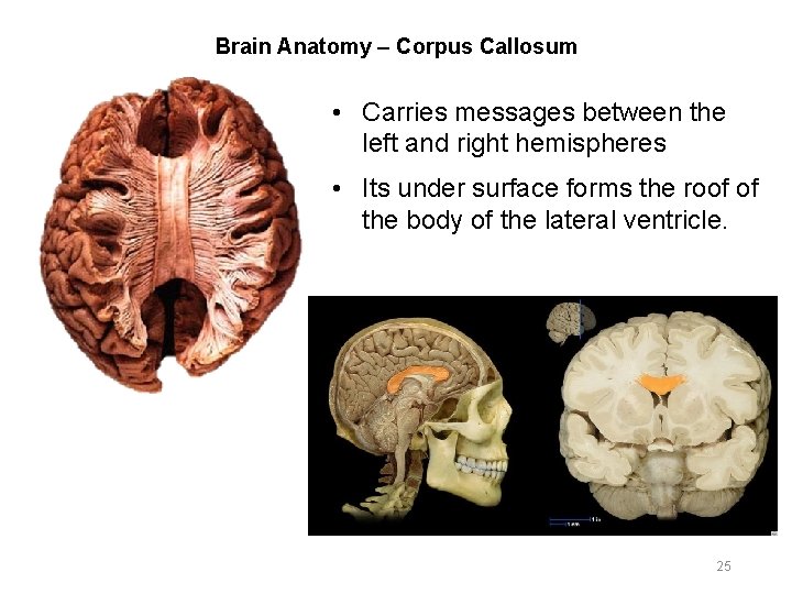 Brain Anatomy – Corpus Callosum • Carries messages between the left and right hemispheres
