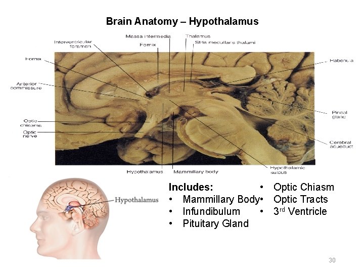 Brain Anatomy – Hypothalamus Includes: • Optic Chiasm • Mammillary Body • Optic Tracts