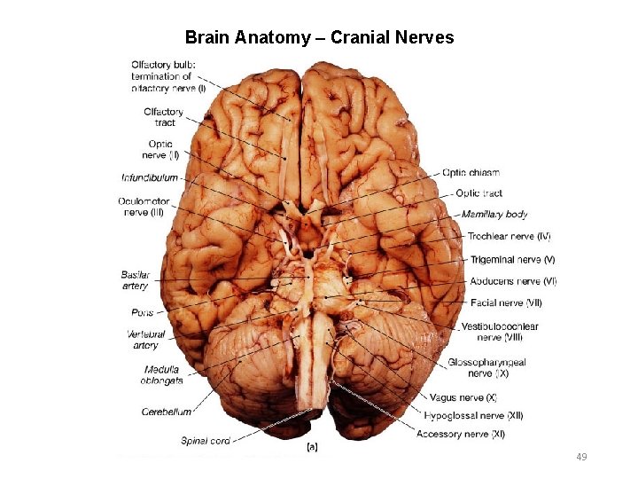 Brain Anatomy – Cranial Nerves 49 