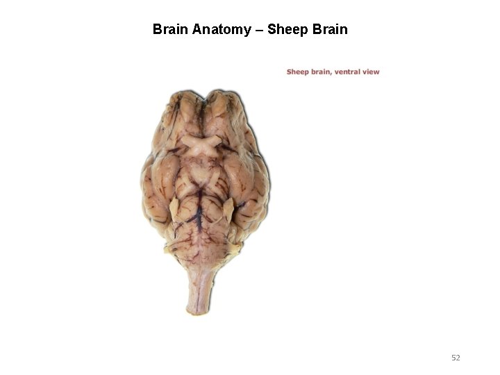 Brain Anatomy – Sheep Brain 52 