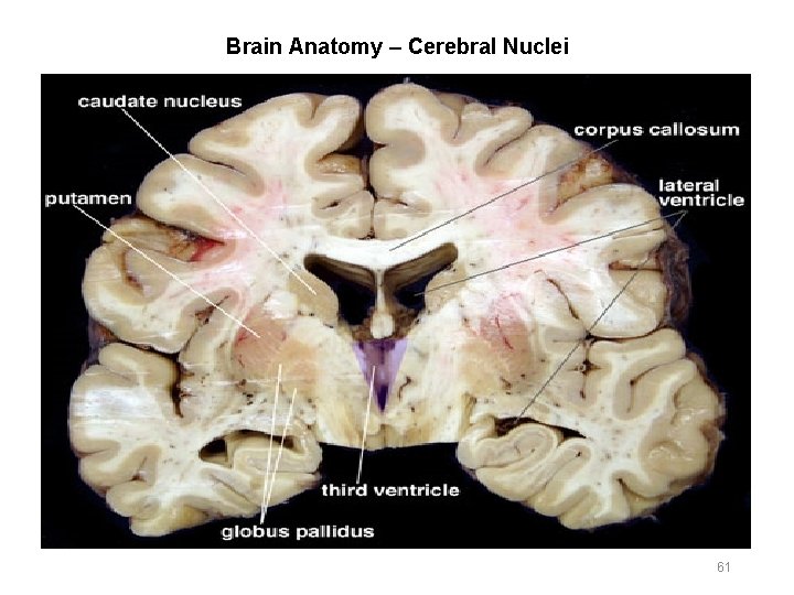 Brain Anatomy – Cerebral Nuclei 61 