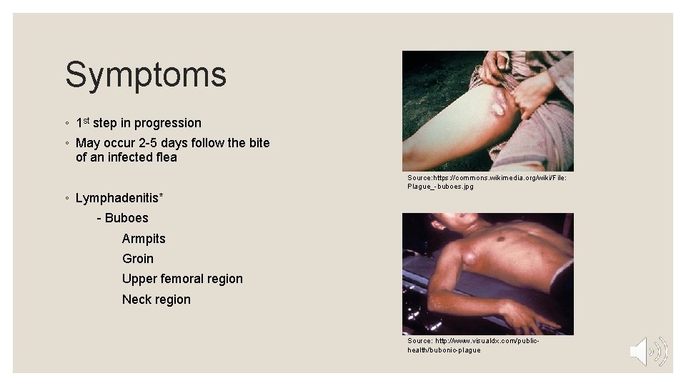 Symptoms ◦ 1 st step in progression ◦ May occur 2 -5 days follow