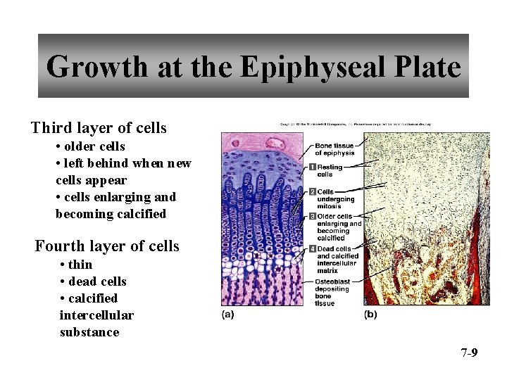 Growth at the Epiphyseal Plate Third layer of cells • older cells • left