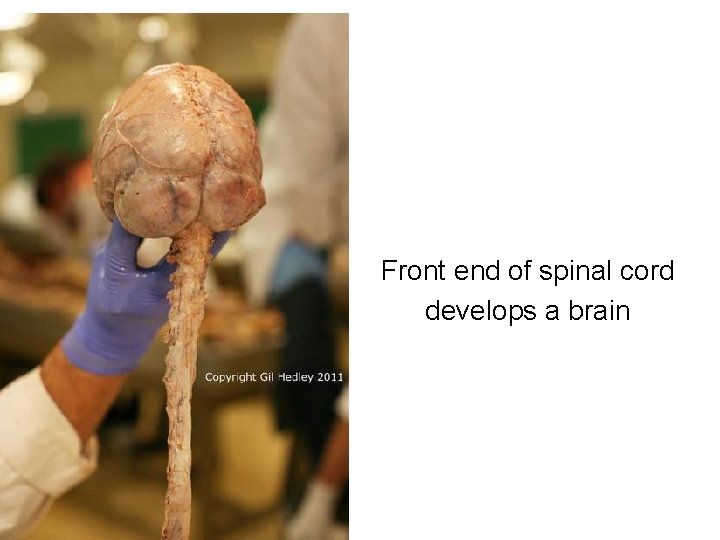 Front end of spinal cord develops a brain 