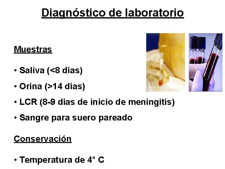 Diagnóstico de laboratorio Muestras • Saliva (<8 días) • Orina (>14 días) • LCR
