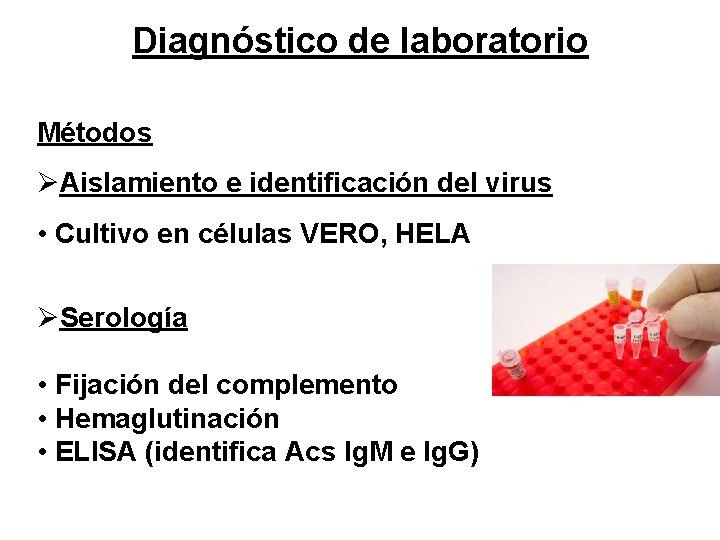 Diagnóstico de laboratorio Métodos ØAislamiento e identificación del virus • Cultivo en células VERO,