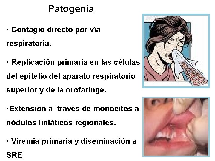 Patogenia • Contagio directo por vía respiratoria. • Replicación primaria en las células del