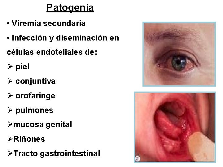 Patogenia • Viremia secundaria • Infección y diseminación en células endoteliales de: Ø piel