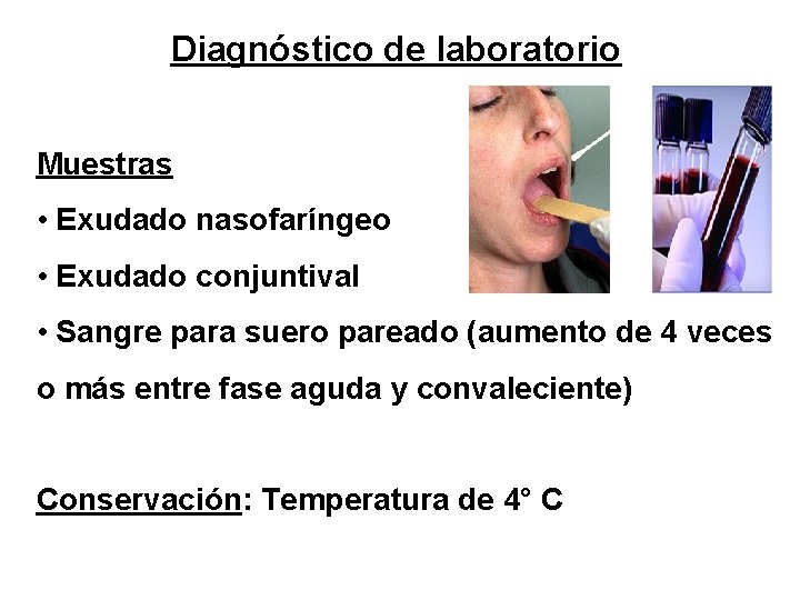Diagnóstico de laboratorio Muestras • Exudado nasofaríngeo • Exudado conjuntival • Sangre para suero