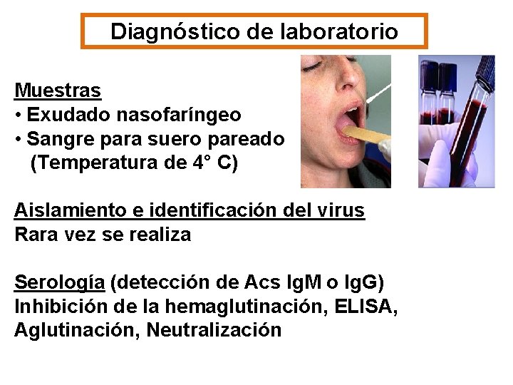 Diagnóstico de laboratorio Muestras • Exudado nasofaríngeo • Sangre para suero pareado (Temperatura de