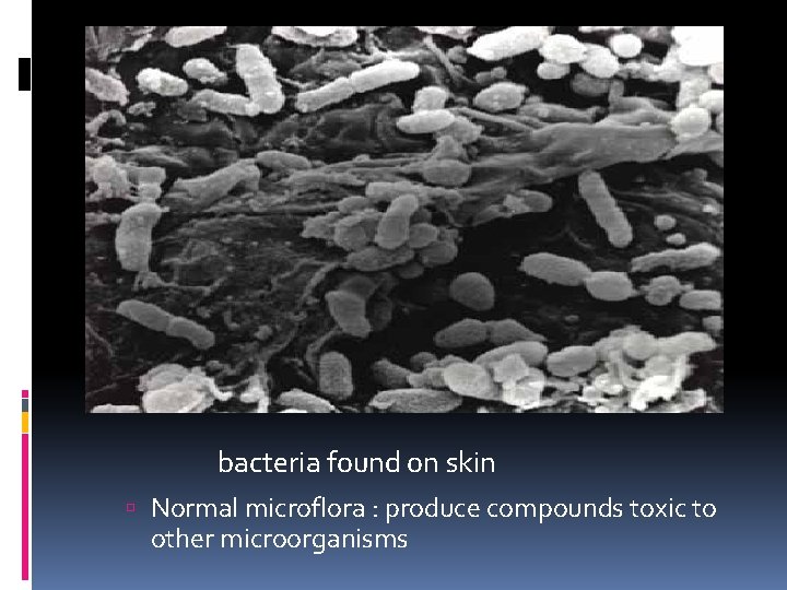 Normal Flora the presence of normal flora cover potential adherence sites for invading microorganism