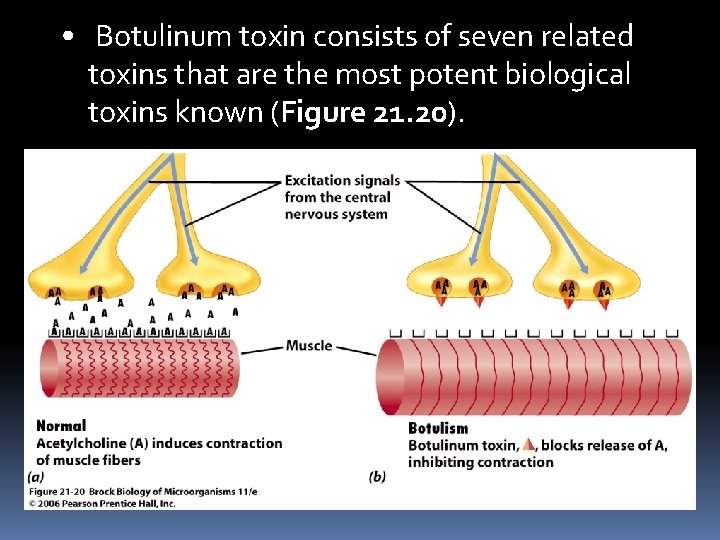  • Botulinum toxin consists of seven related toxins that are the most potent