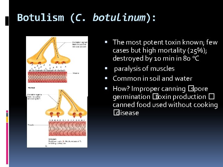 Botulism (C. botulinum): The most potent toxin known; few cases but high mortality (25%);