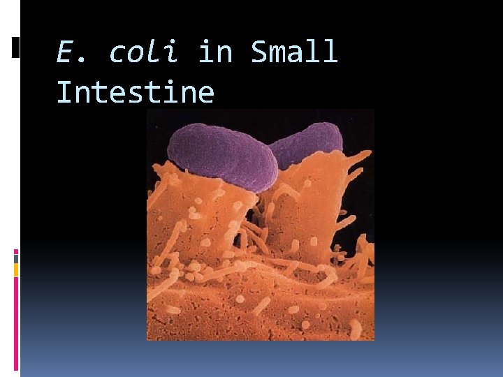 E. coli in Small Intestine 