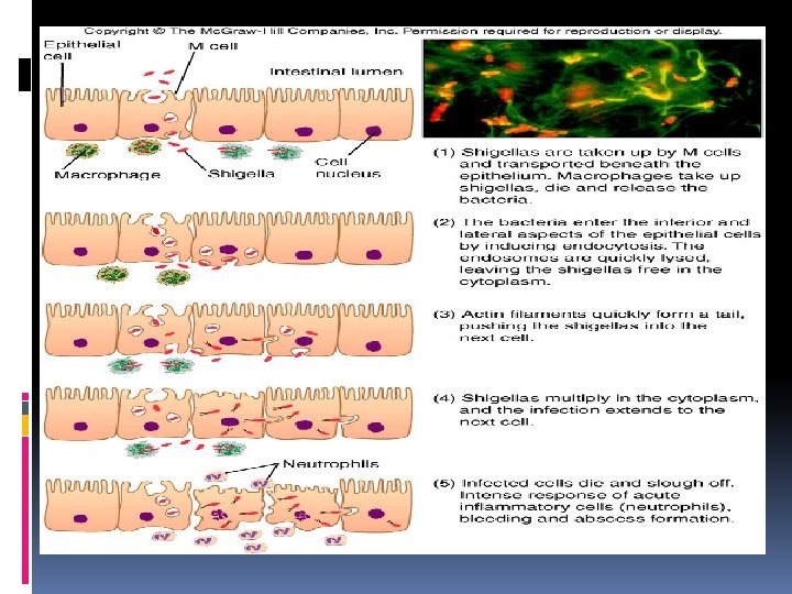 Shigellosis Pathogenesis S. dysenteriae Rarely encountered in United States Produces potent A-B toxin Shiga