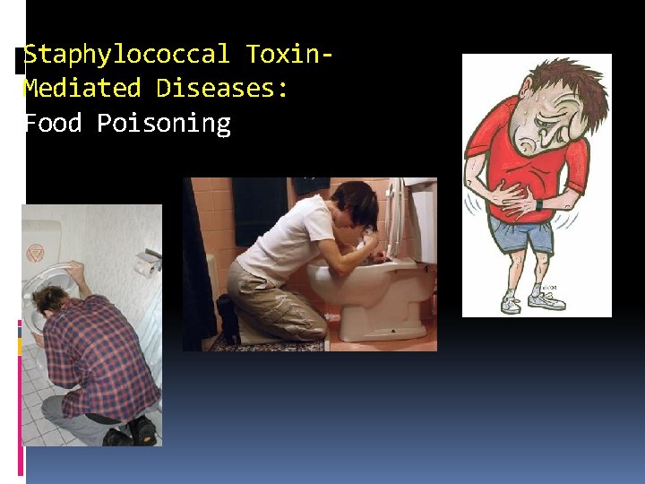 Staphylococcal Toxin. Mediated Diseases: Food Poisoning 