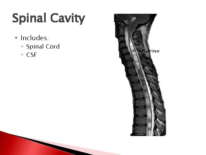 Spinal Cavity Includes: ◦ Spinal Cord ◦ CSF  Spinal Cavity Includes: ◦ Spinal Cord ◦ CSF