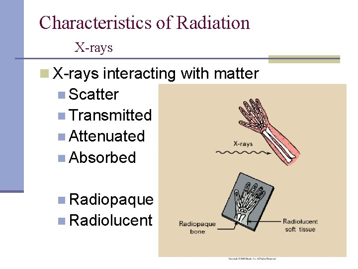 Characteristics of Radiation X-rays interacting with matter n Scatter n Transmitted n Attenuated n